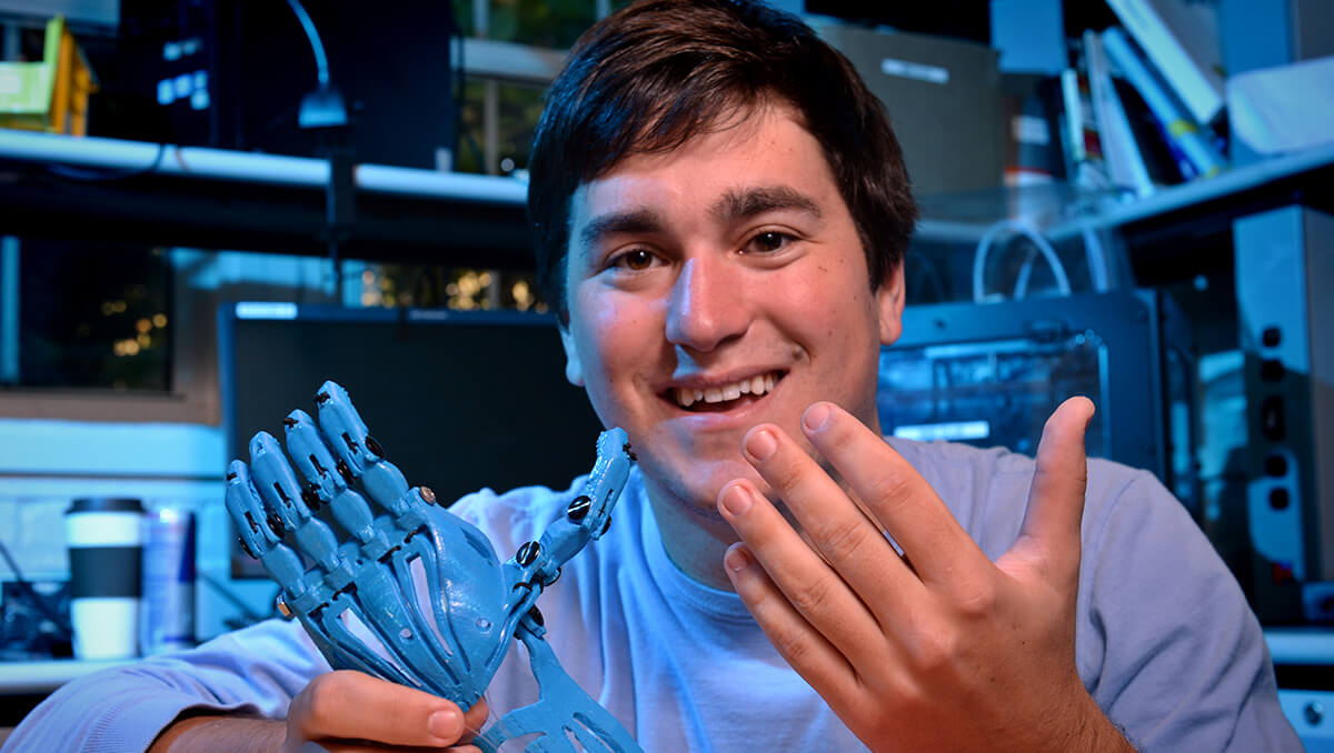 Jeff Powell holds a prosthetic hand.