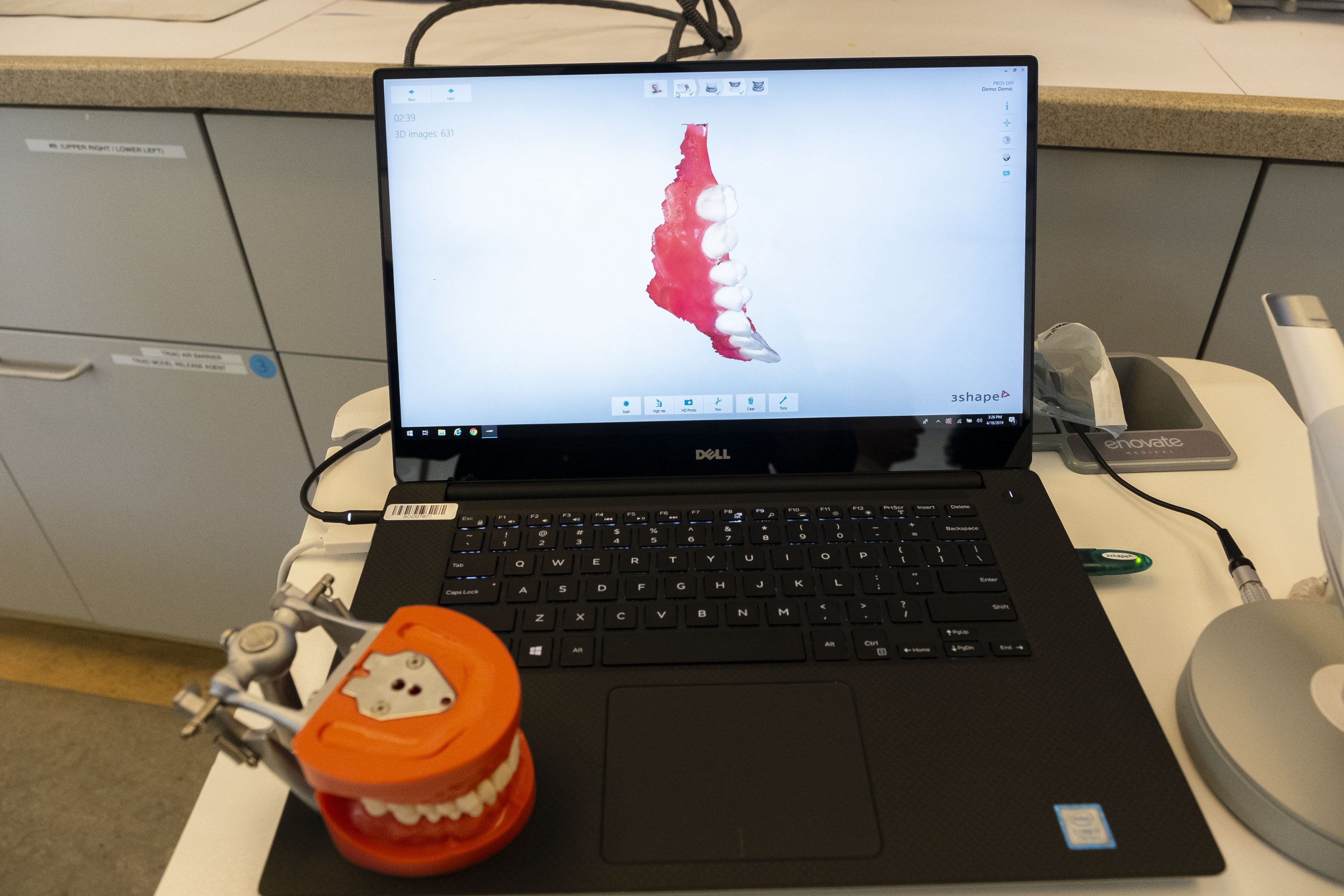 A model of teeth on a laptop.
