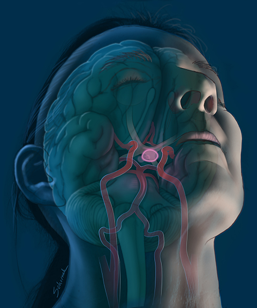 An image created by Schornak to show the location of the pituitary gland and blood vessels near it .